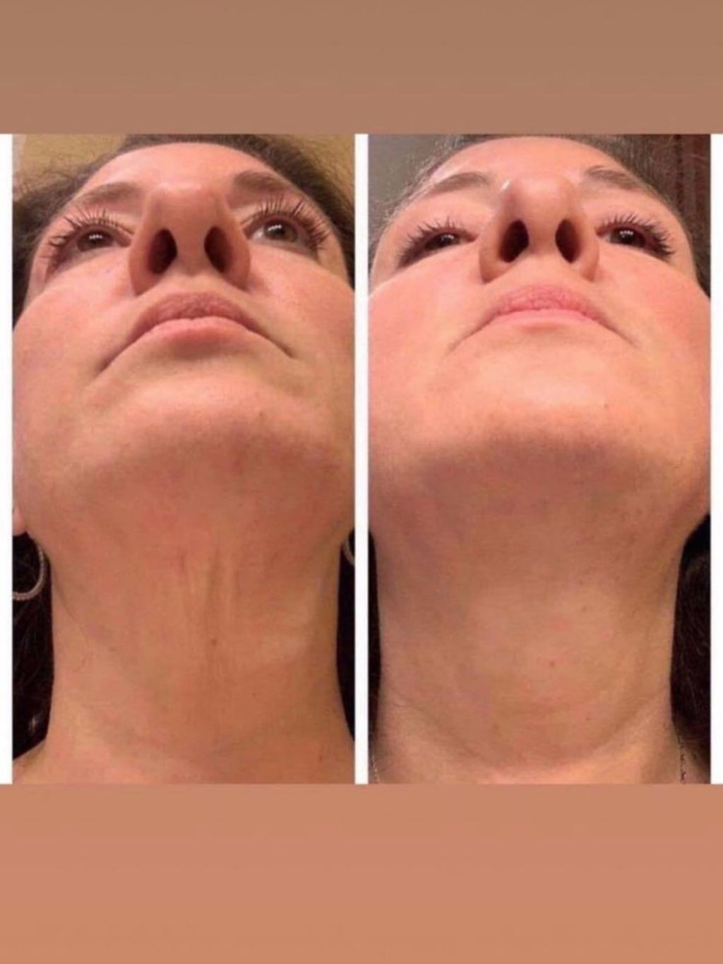 Neck Firming Cream Lift for Wrinkle Neck, Lines & Loose Skin