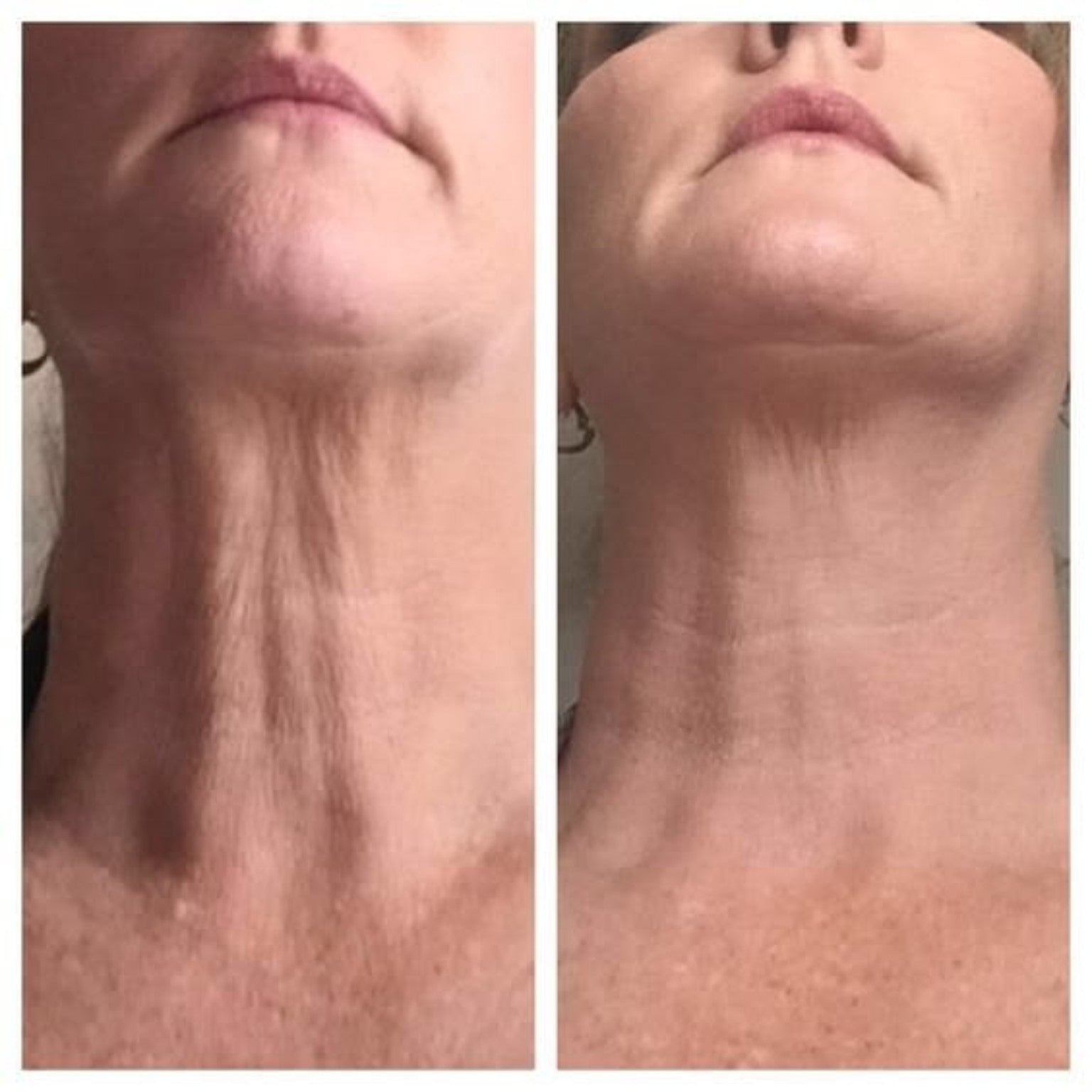 Neck Firming Cream Lift for Wrinkle Neck, Lines & Loose Skin
