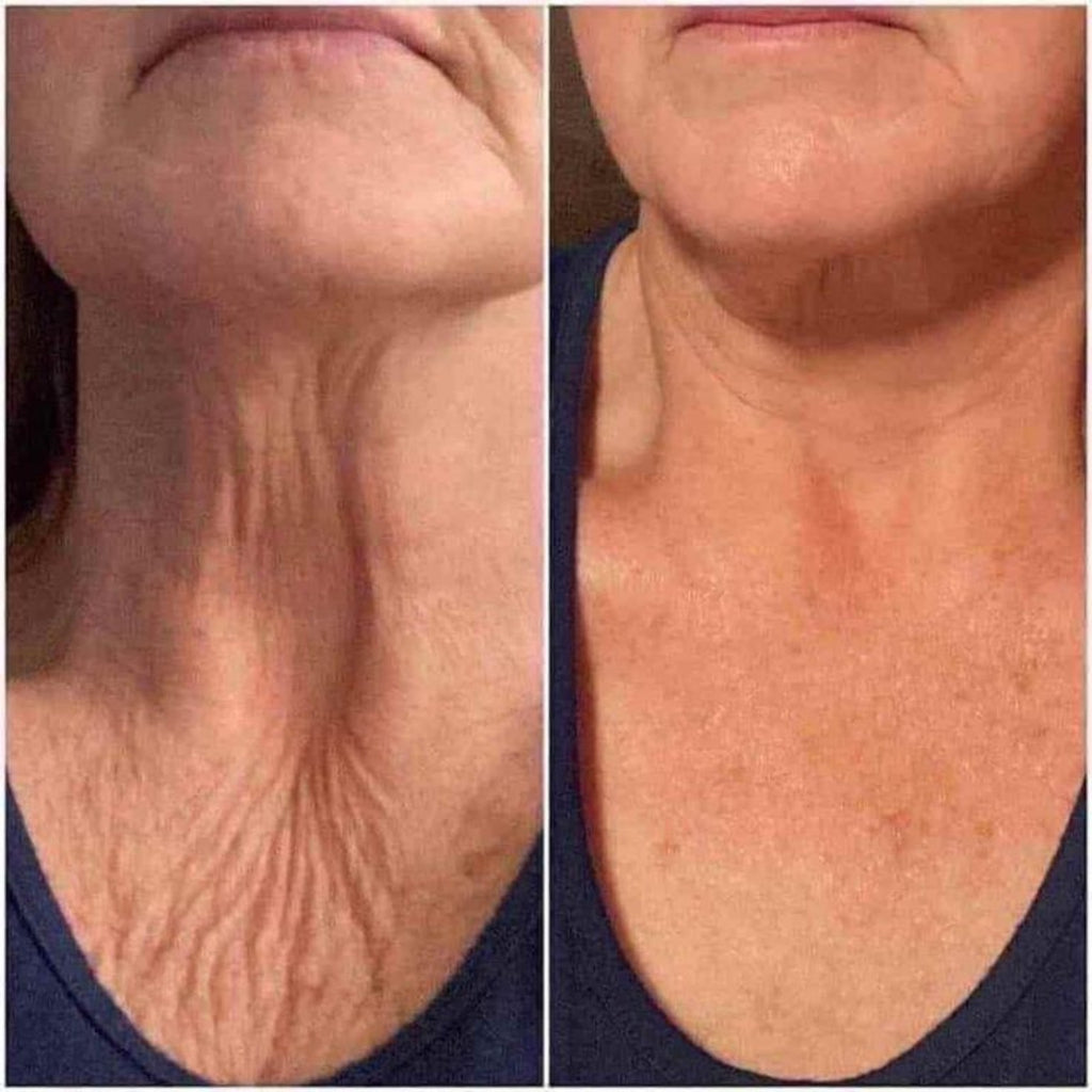Neck Firming Cream Lift for Wrinkle Neck, Lines & Loose Skin