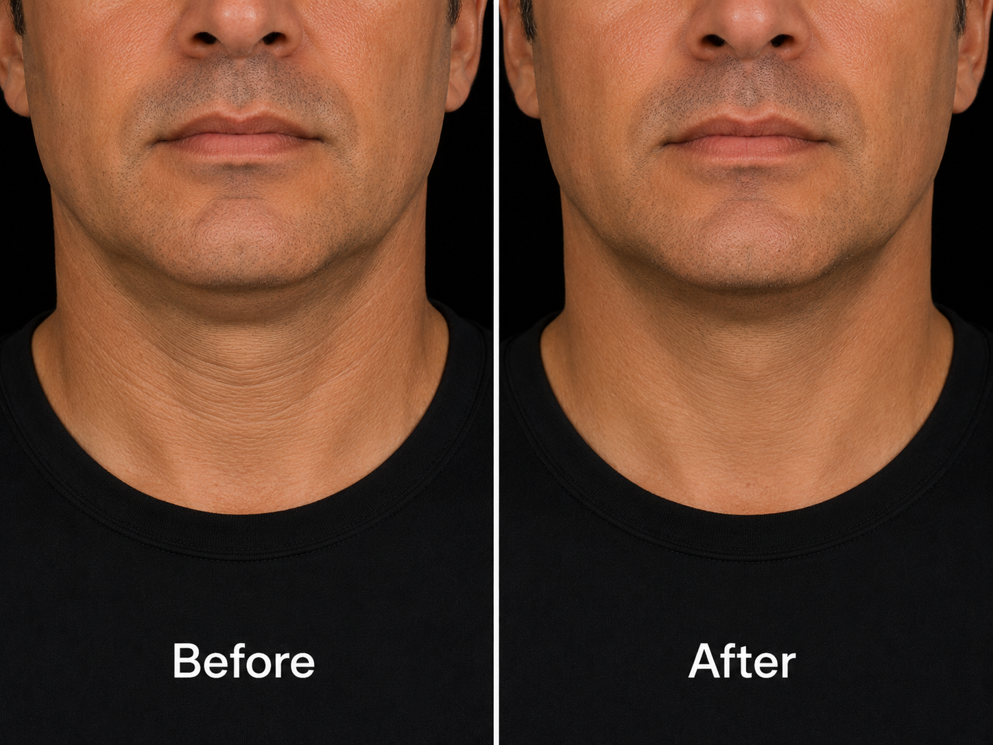 Neck Firming Cream Lift for Wrinkle Neck, Lines & Loose Skin