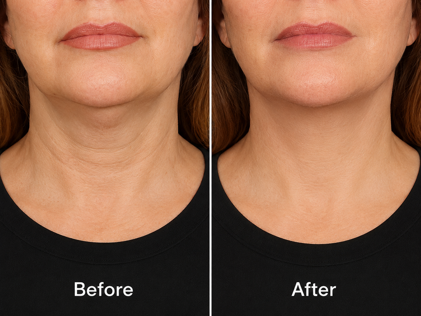 Neck Firming Cream Lift for Wrinkle Neck, Lines & Loose Skin